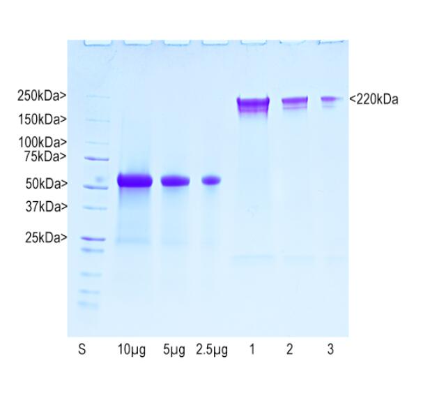 Coomassie brilliant blue stained SDS-PAGE gel of cow pNF-H preparation. First lane shows molecular weight standards of indicated molecular size. Next three lanes show BSA at 10, 5 and 2.5 μg respectively as indicated. Next three lanes show undiluted, 1:1 diluted and 1:4 diluted aliquots of the pNF-H preparation. The pNF-H was isolated from cow spinal cord using a modified version of the Triton X100/sucrose extraction method of Leung and Liem as far as the 6M urea solubilization and batch ion exchange chromatography on hydroxyapatite step. The material was then fractionated using a phosphate gradient of 10mM to 300mM on DEAE-cellulose in 6M urea at pH=7.5. The pNF-H elutes cleanly at about 50mM phosphate as shown. The cow pNF-H runs on SDS-PAGE with an apparent molecular weight of 220kDa.